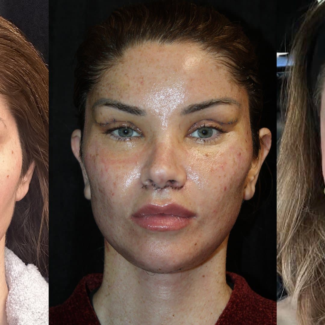 JIYA before and after result 1